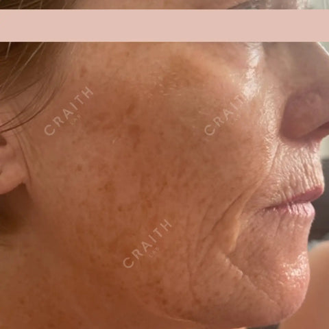 Craith Lab Bionetic Collagen Serum Day & Night