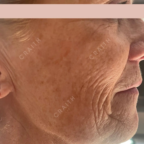 Craith Lab Bionetic Collagen Serum Day & Night
