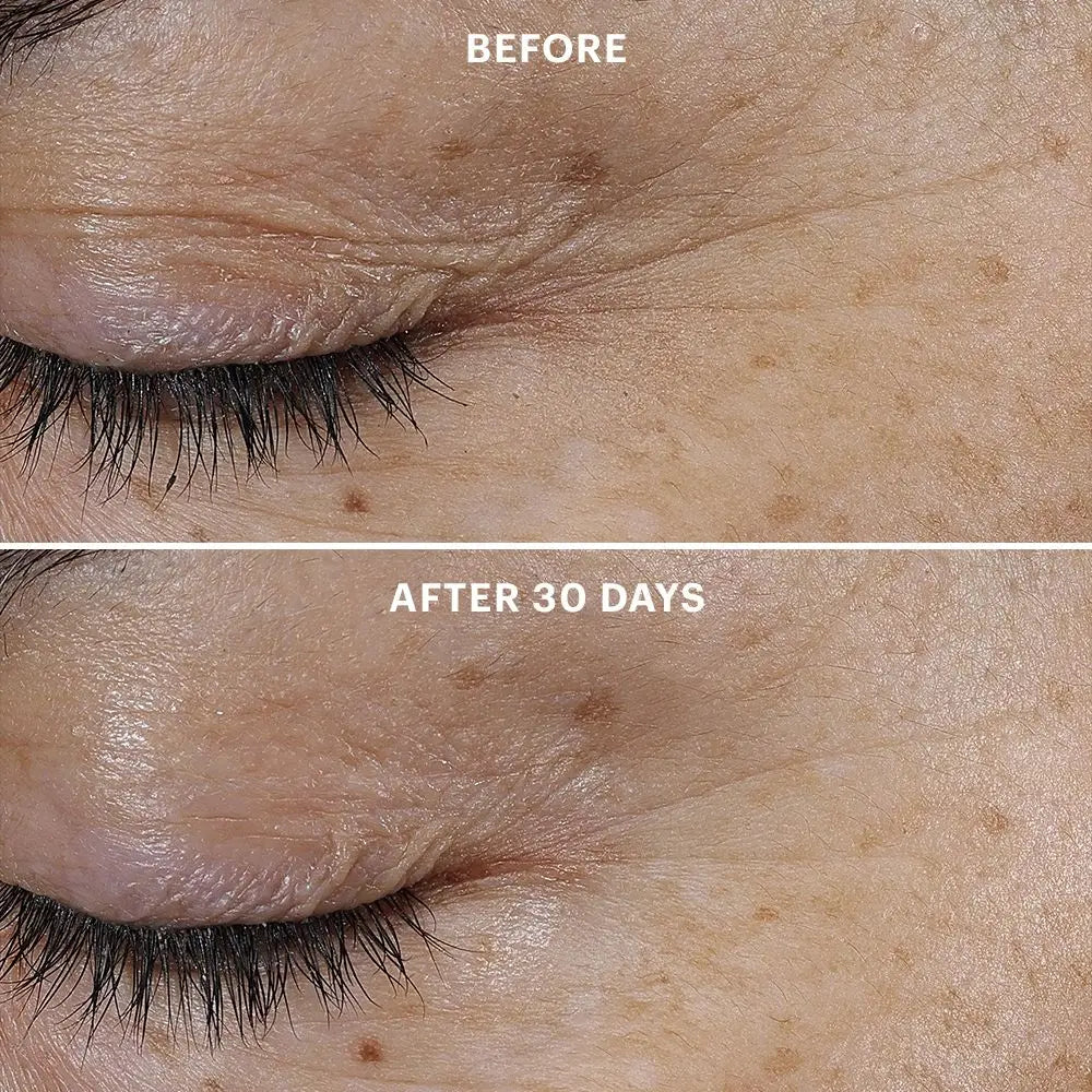 Glo Skin Beauty Bio-Renew EGF Eye Cream 15ml